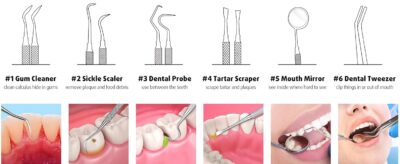 Professional Dental Hygiene Kit - Image 2